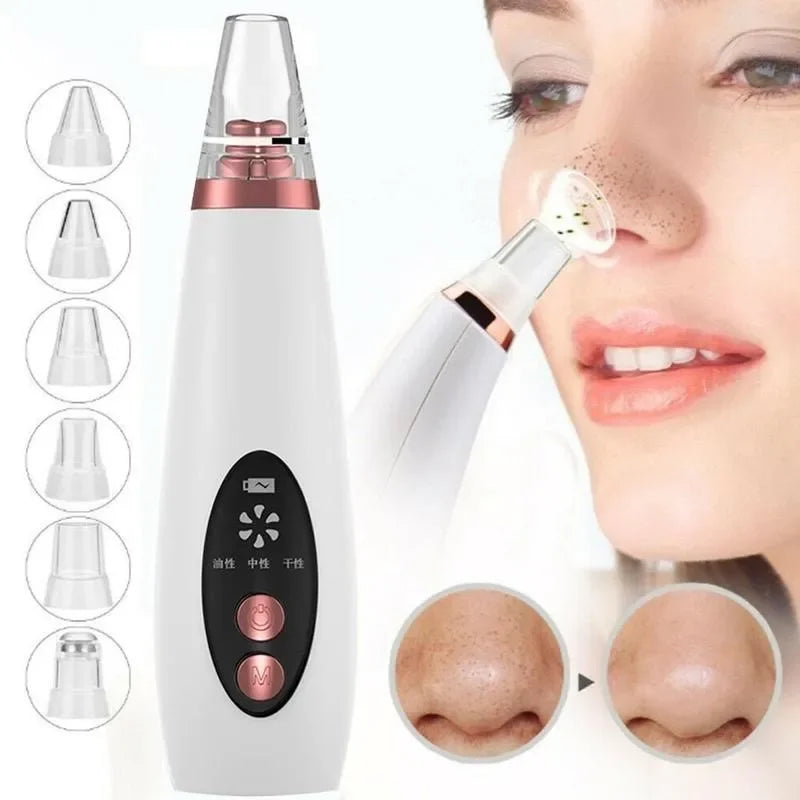 USB Rechargeable Facial Pore Vacuum and Acne Remover - Deep Cleansing Skin Care Tool with Black Dot Cleaner for Pimple Removal