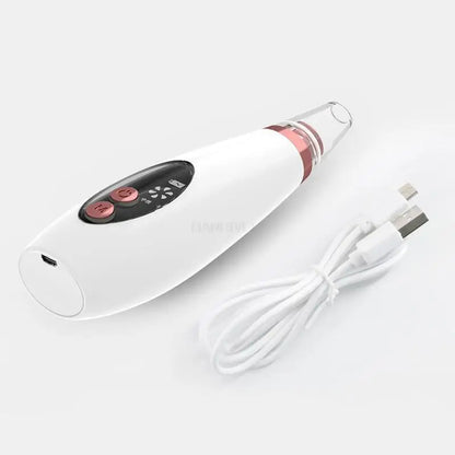 USB Rechargeable Facial Pore Vacuum and Acne Remover - Deep Cleansing Skin Care Tool with Black Dot Cleaner for Pimple Removal