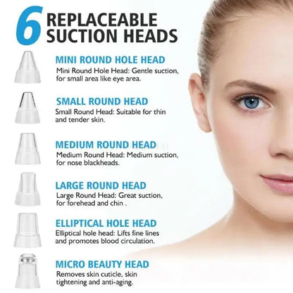 USB Rechargeable Facial Pore Vacuum and Acne Remover - Deep Cleansing Skin Care Tool with Black Dot Cleaner for Pimple Removal